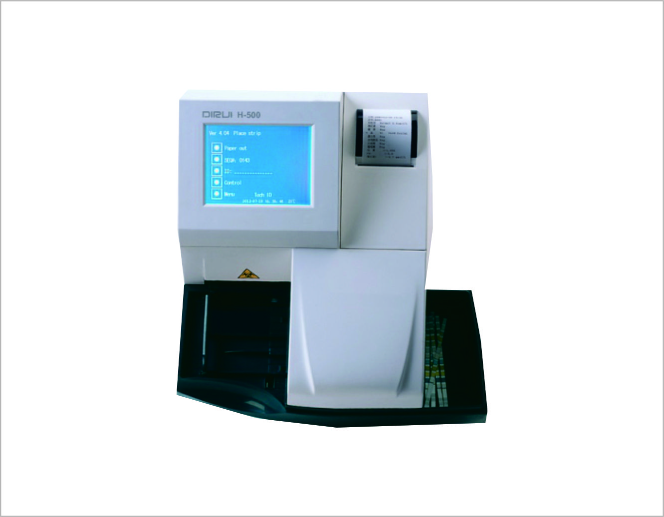 Urinalysis: What Can Be Learned from a Urine Sample